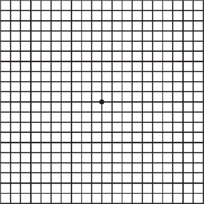 AmslerGrid